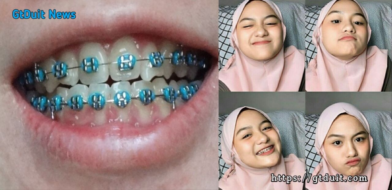 Bahaya bahel fashion bagi kesehatan, ini alasanya