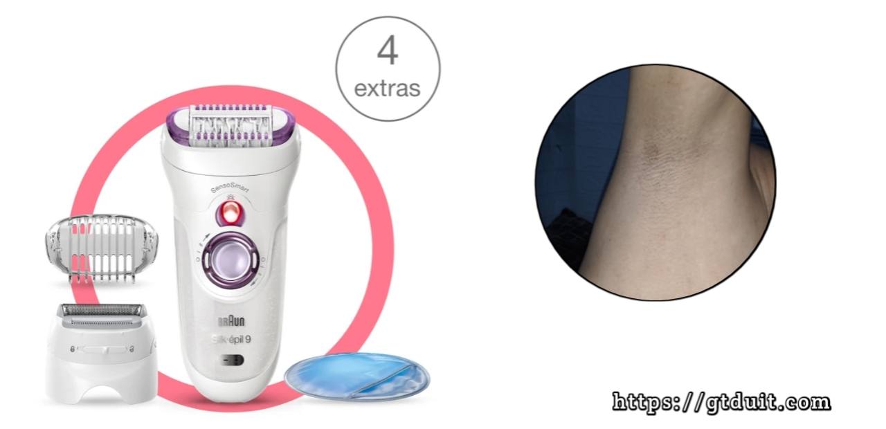 Bagaimana cara menghilangkan rambut dengan epilator?