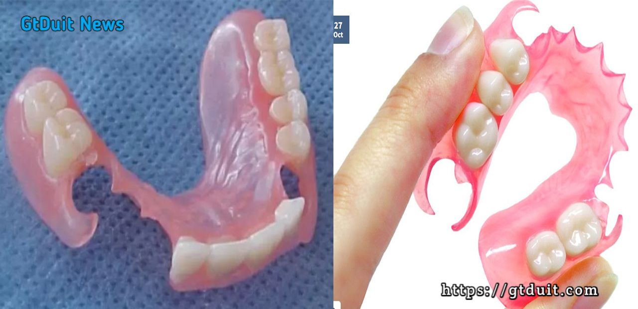 Cara merawat gigi tiruan agar lebih awet